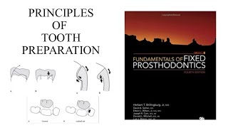 Principles of Tooth Preparation lecture from Shillingburg | Part-1
