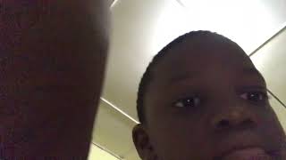 My tooth fall out