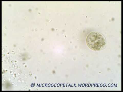 Unknown Ciliate - could it be Tetrahymena that about to go into cyst stage