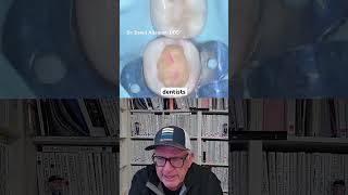 How to Create Successful Large Composite Restorations