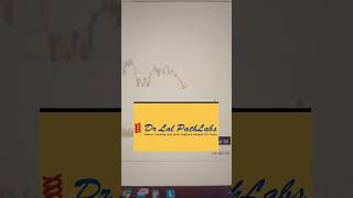 would you buy these stocks #stockstobuytoday #stocktoinvest #stockstoinvest #stockstobuytoday