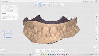 MEDIT MODEL BUILDER (Modelo zocalado)