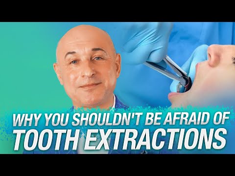 Tooth Extractions: Why You Shouldn't Be Afraid