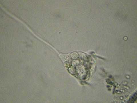 Vorticella Video