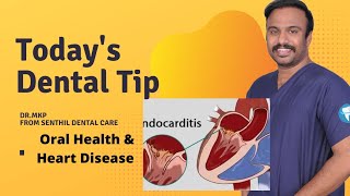 Oral Health and Heart Disease | ENDOCARDITIS | Dentist in Chennai Madurai Chennai | Dr.MKP