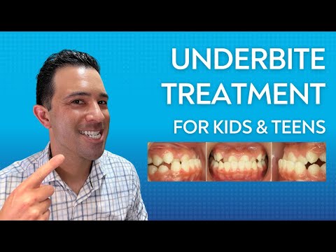 Predictable Fix for Underbites in Kids & Teens (Ages 7-15)