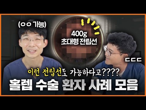 🚨 초대형 전립선 비대조직 제거한 썰? | 홀렙 수술 환자 사례 모음 zip
