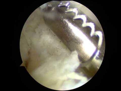 VID 005