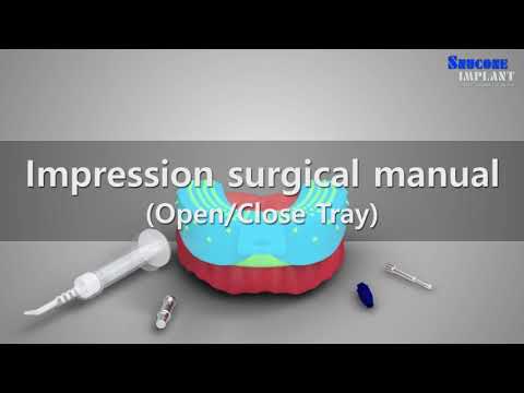 Implant impression using contents.