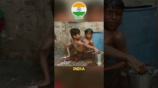 Two-Legged Four Armed Conjoined Twins! 😱