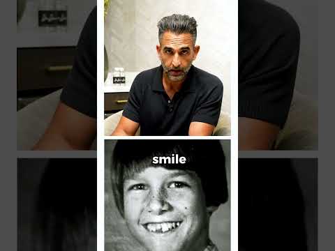 How Tom Cruise fixed his smile? #shorts #cosmeticdentistry