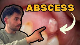Dentist Explains How To Tell If You Have a DEAD Tooth?
