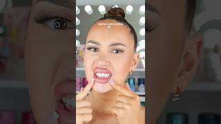 Every Dentist Noticed This SCARY Issue, But Did You?! 😳🦷