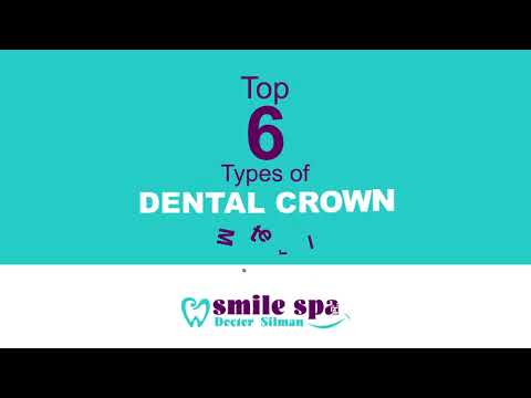 Top 6 Types of Dental Crown Material