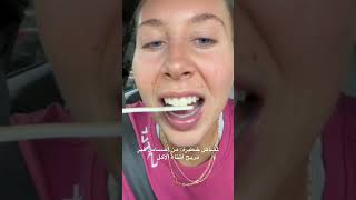 #veneersdubai #dentist #beautifulsmiledubai #aligners