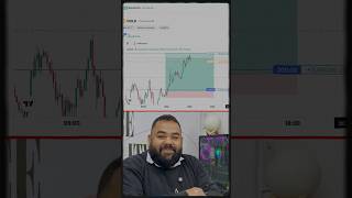 This Candlestick Pattern Changed Everything! 😱Live XAUUSD Trade | Gold Trading Secrets#learntrading