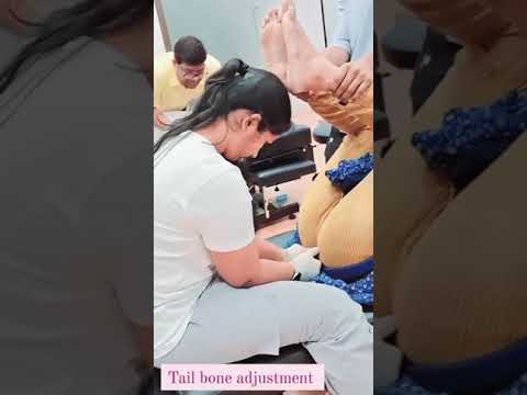 tail bone treatment join  #foryou #foryoupage #viral #videos #tailbone #pain #treatment