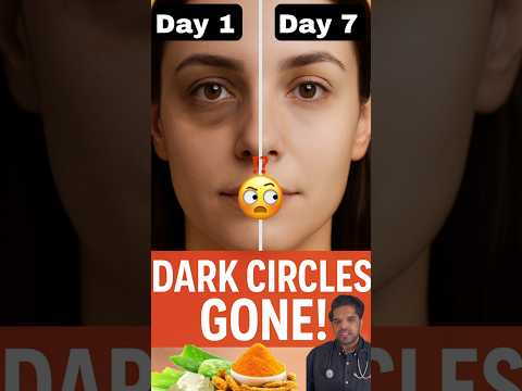 Dark Circles ka Natural illaj 👌😉 | #shorts #darkcircles #drawaisjaved