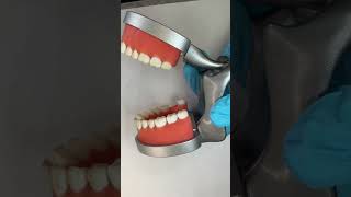Tip for scaling the distal of the 3rds