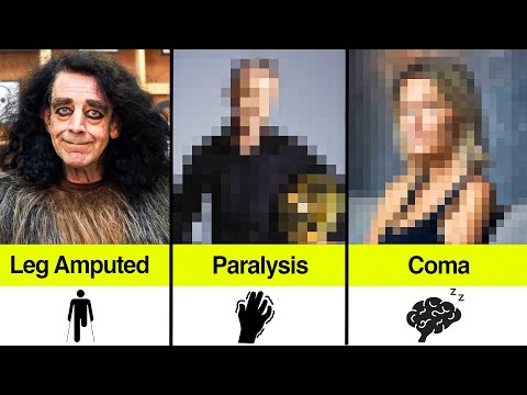 Star Wars Actors Who Got LIFELONG Disabilities From Filming