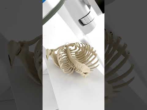Medical Animations with MedBlend in Blender #dicom #3danimation #blenderanimation
