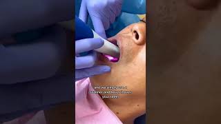 Dental Digital Scanner 🦷