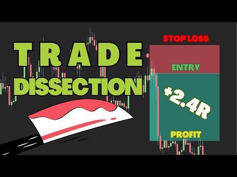 USD/JPY Trade Dissection