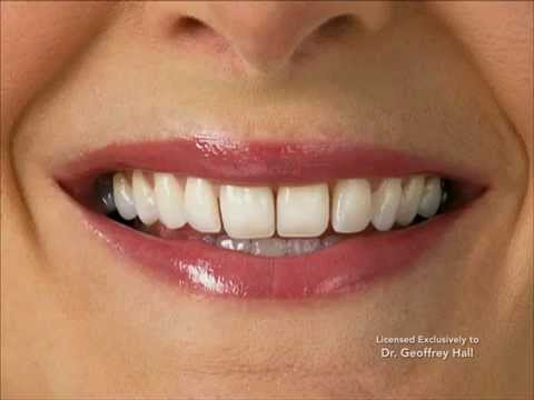 Advanced Orthodontics - IPR