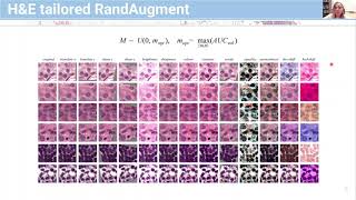 MIDL 2021, I12, Faryna et. al., Full Paper