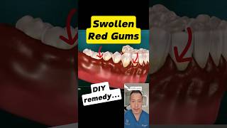 Red, Sore Gums? Fix Them in 3 Easy Steps! #dentallan #dentist #shorts