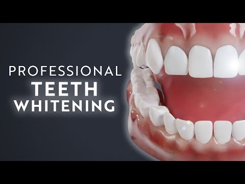 The Power of Professional Teeth Whitening