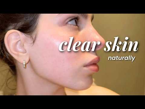 How ANYONE can achieve CLEAR SKIN *naturally* (sirf teenagers)