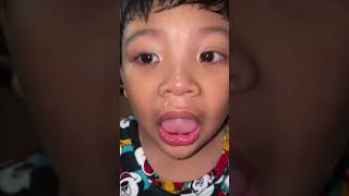 Baby tooth fall out #LifeOfDodong #ToothFairy #ToothFallOut
