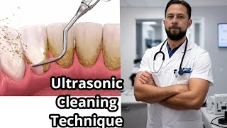 Achieve Sparkling Teeth with the Ultimate Ultrasonic Cleaning Technique #teeth #teethcleaning