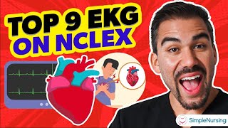 EKG Rhythms Simplified: Top NCLEX Patterns & Treatments