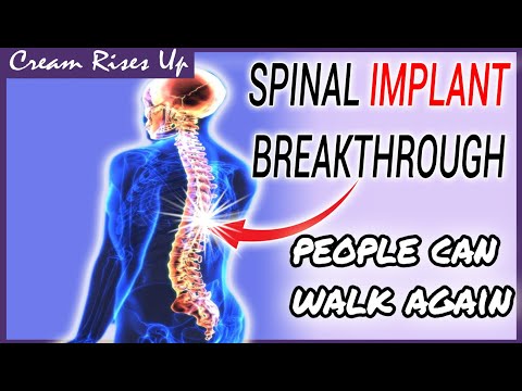 A Groundbreaking Spinal Implant For Paralyzed Patients | Light At The End Of The Tunnel!