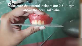 Anterior Teeth Setting - Complete Denture #5 | Preclinical Prosthodontics | Dental Occlusion