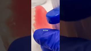 How to Clean Your Dentures the Right Way | Aspen Dental Care Tips