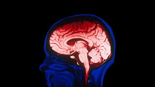 Self-improvement is f***ing your brain