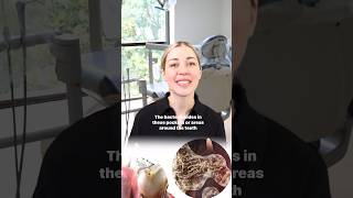 What are the benefits of Osseous Surgery? #dentistexplains #dentalhygiene #dentistadvice #dentist