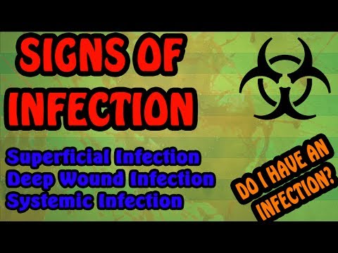 Signs of Infection - Signs and Symptoms