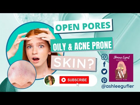 #openpores #blackheads  Open Pores