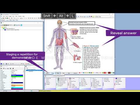 SuperMemo Image Occlusion Editor