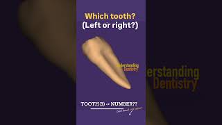 Which Tooth is this? (Left or right side?) #toothanatomy #dentalanatomy  #dentalstudents