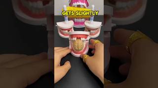 No Dentist? No Problem – Instant Tooth🦷Repair😁👌 #youtubeshorts #shortsfeed #shorts #ytshorts #beauty
