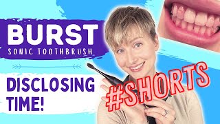 BURST Disclosing Time! | Unsponsored Review | #shorts