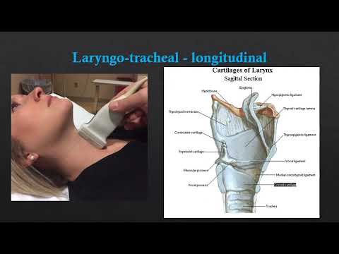Neck US - Basic Anatomy