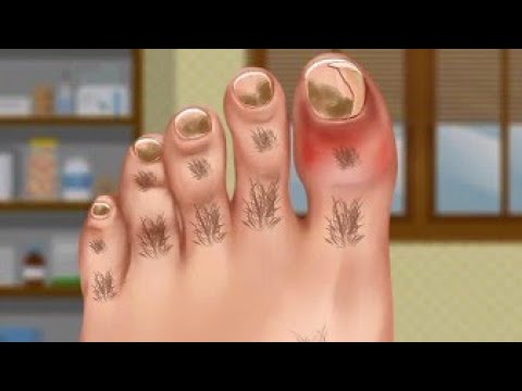 Foot surgery and treatment