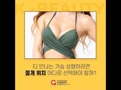 가슴성형, 흉터 걱정 넣어둬 넣어둬!!