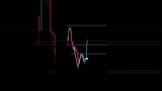 W PATTERN  #trading #stockmarket #howtotradechartpatterns  #forex